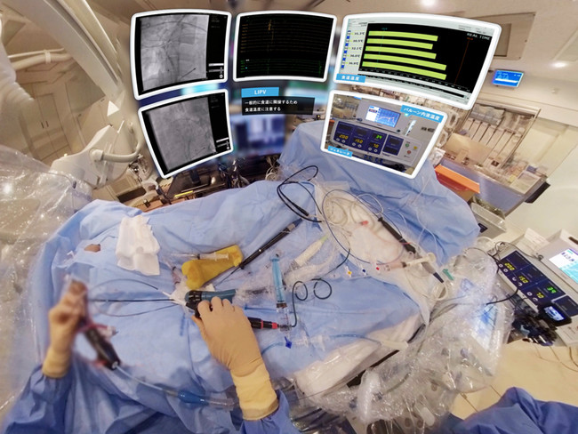 東レの医療機器教育VRを開発！コロナ禍でもHotBalloon™️治療の適正な教育をVRで提供、普及を加速